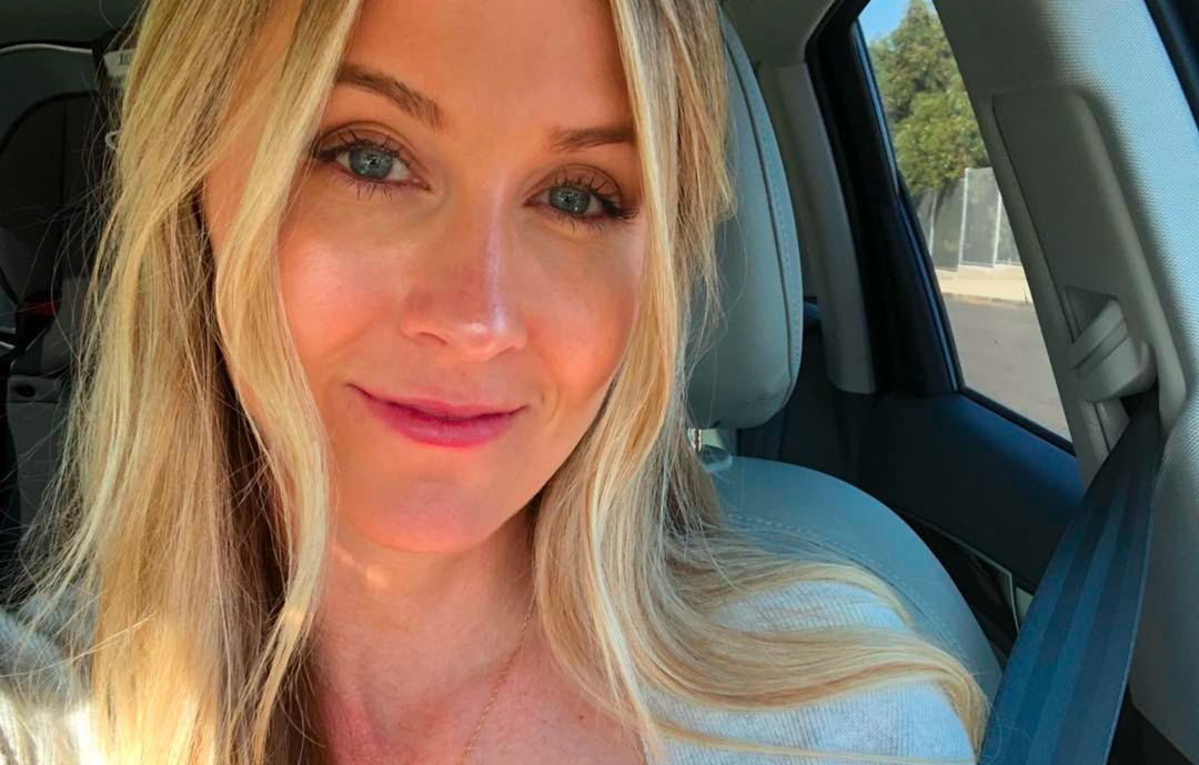 antalya ameliyatsız burun estetiği